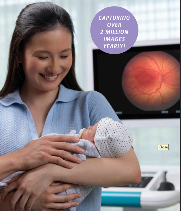 ZEISS Products Nepal